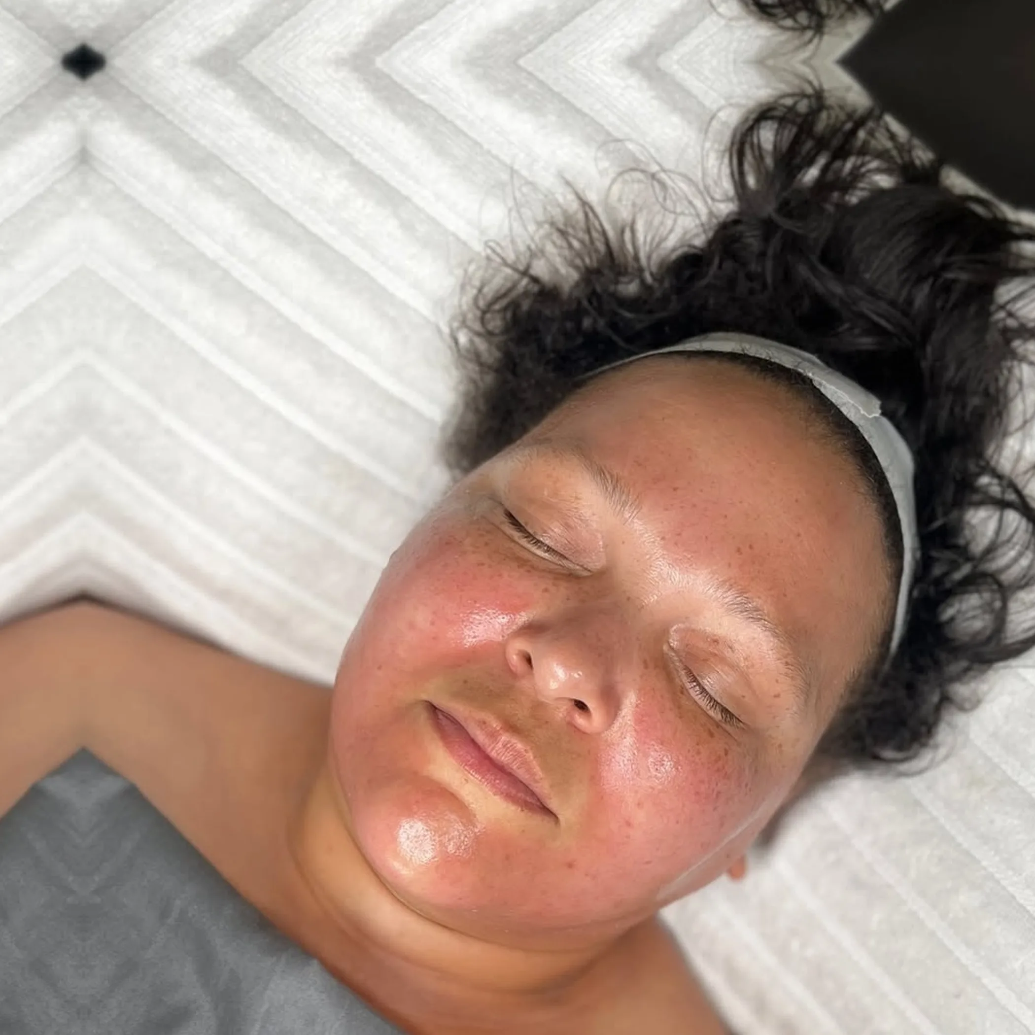 smooth radiant skin treatment result